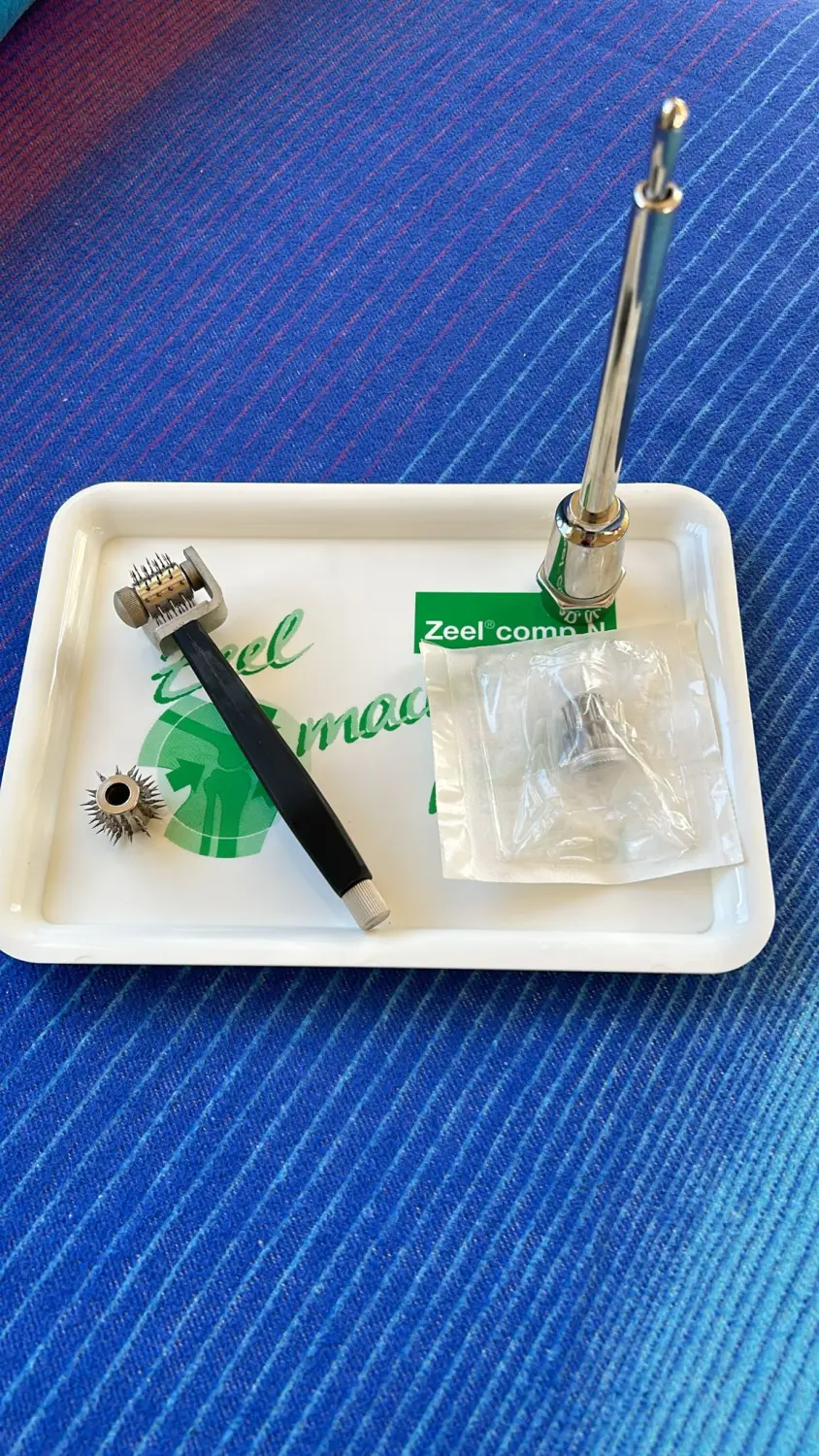 Baunscheidtieren von Naturheilpraxis und Apothekenvertretung