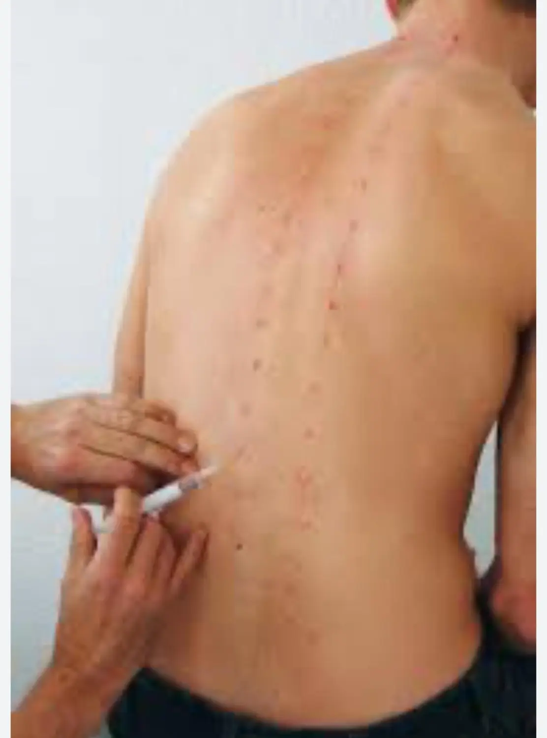Neuraltherapie (Auszug aus dem Handbuch für Neuraltherapie) von Naturheilpraxis und Apothekenvertretung